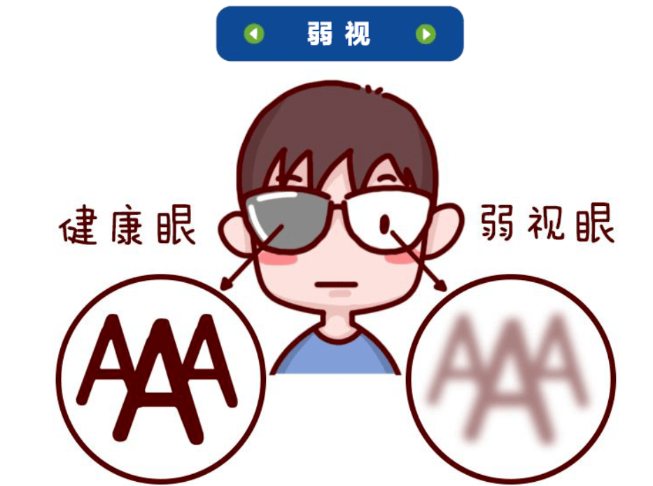 永春爱尔眼科视觉训练助其弱视视力显著提升瓦力游戏试玩6岁男童战胜“双重视力挑战”(图3) 永春爱尔眼科视觉训练助其弱视视力显著提升瓦力游戏试玩6岁男童战胜“双重视力挑战”(图3)